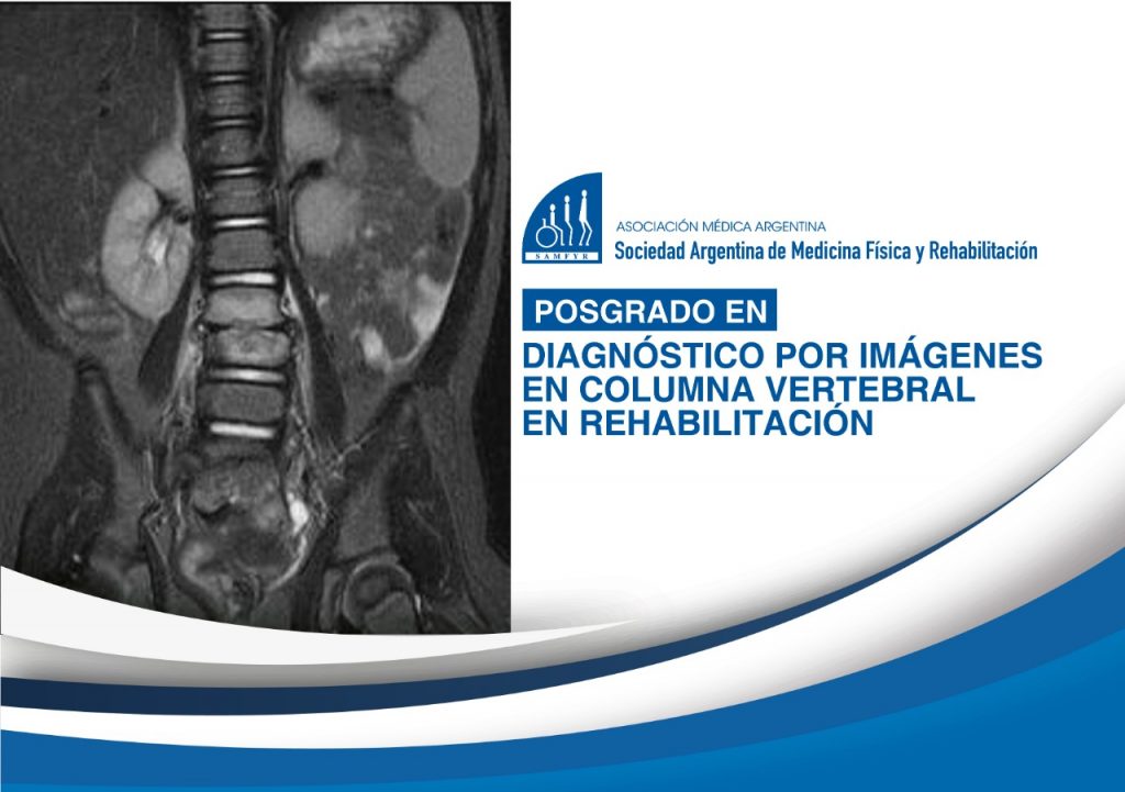 Diagnóstico por imágenes en columna vertebral en rehabilitación